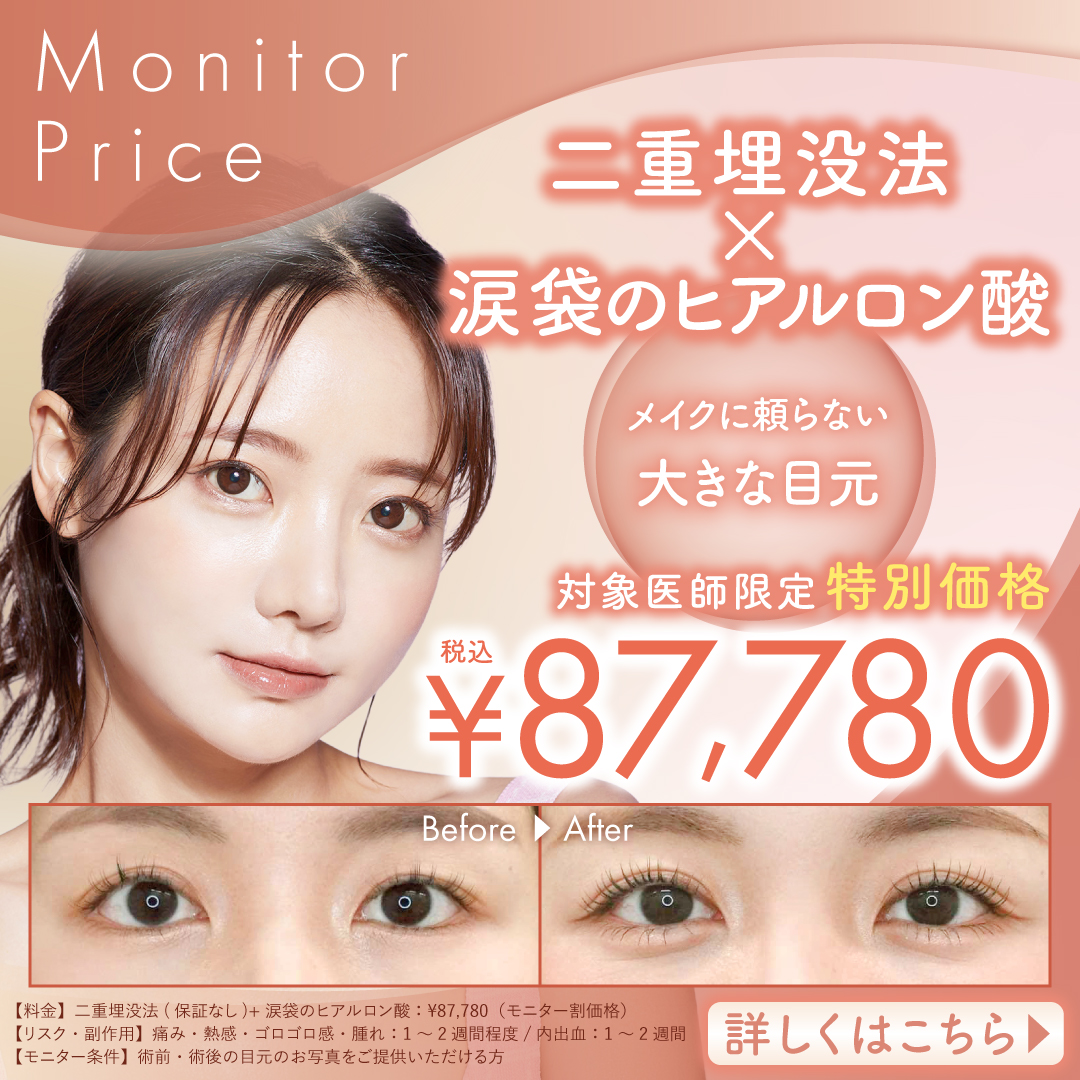 二重埋没法＋涙袋のヒアルロン酸がお得なセットメニューになって新登場