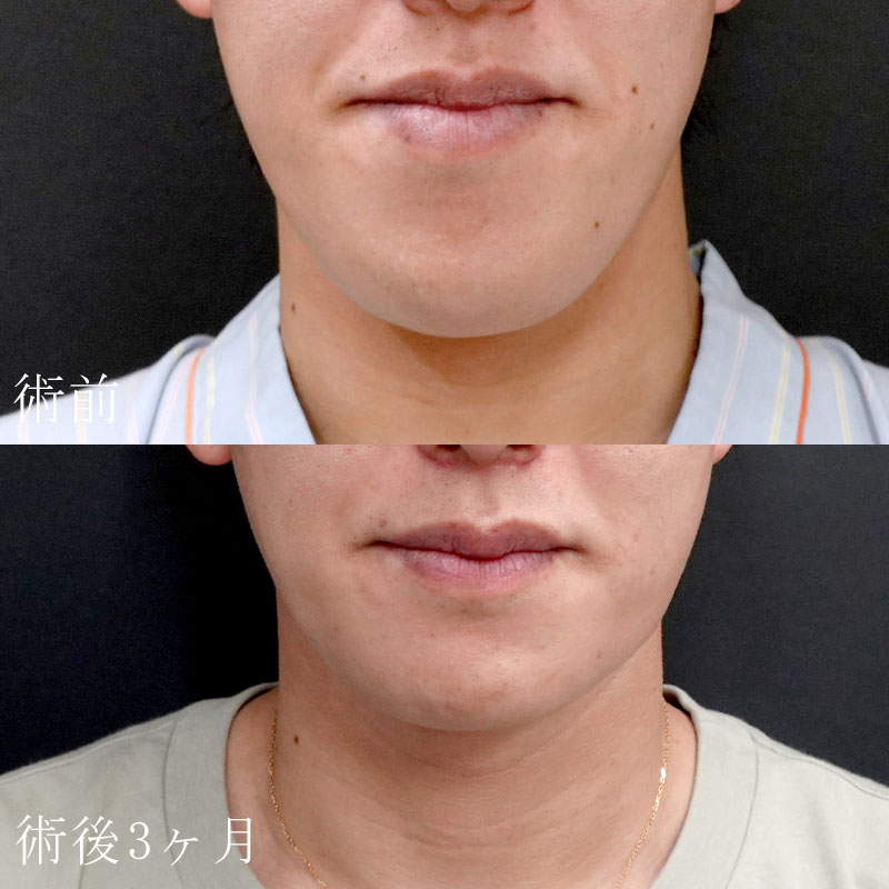 20251102_G127067_nishida_Mental formation -1メイン横