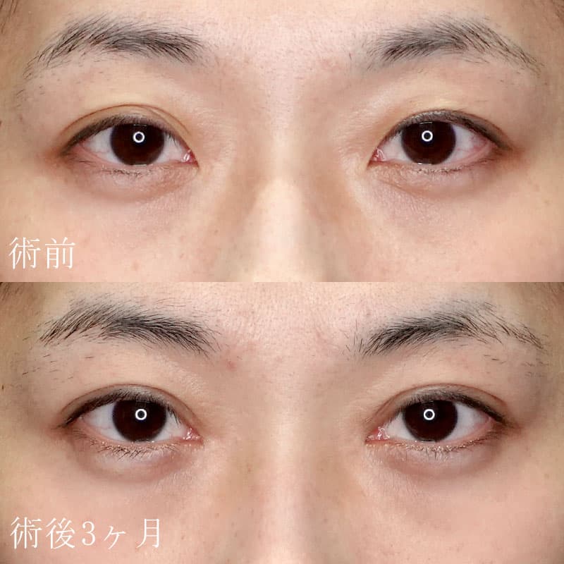 銀座院 石原医師執刀