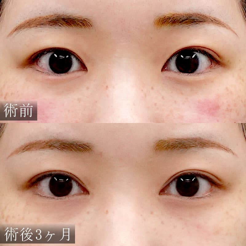 梅田院 杉島医師執刀