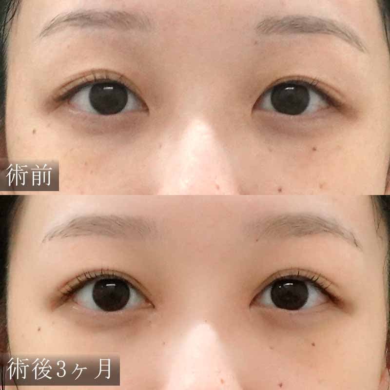 心斎橋院 金子医師執刀