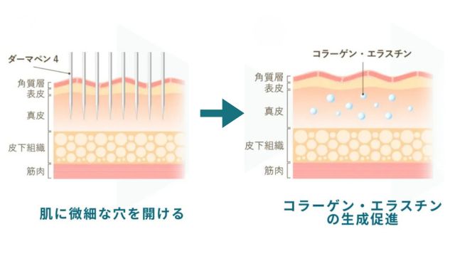 コラーゲンやエラスチン生成の説明