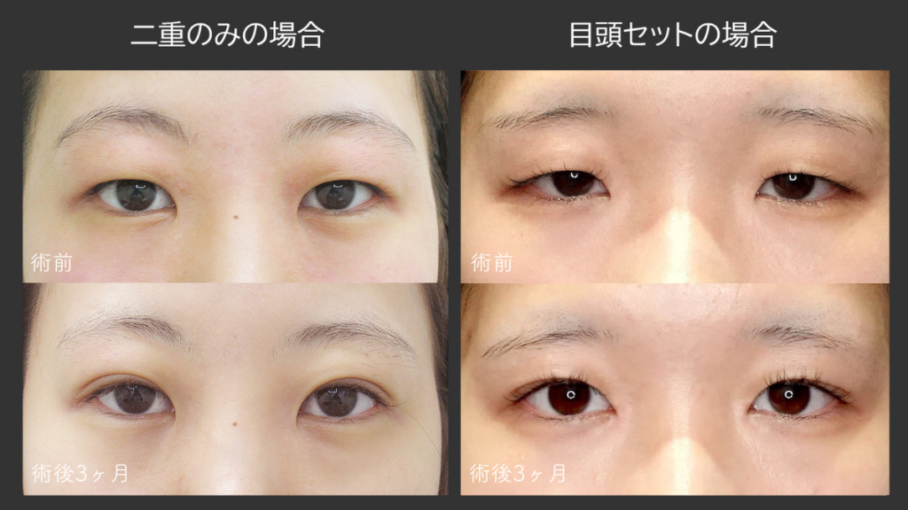 目を横方向に大きく見せる