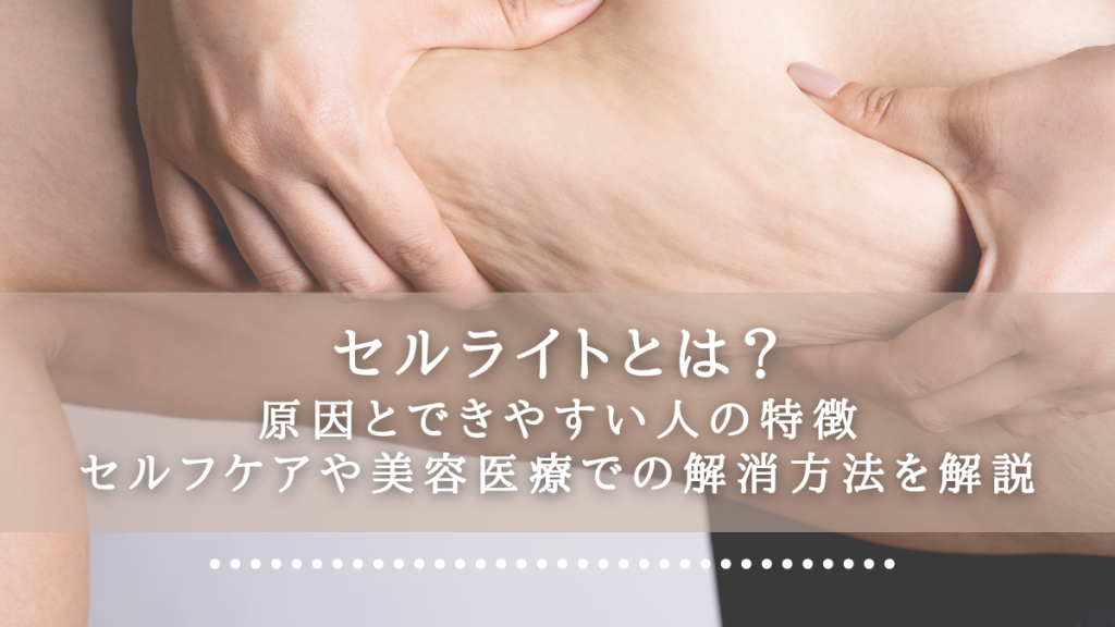 セルライトとは？原因とできやすい人の特徴、そしてセルフケアや美容医療での解消方法を解説