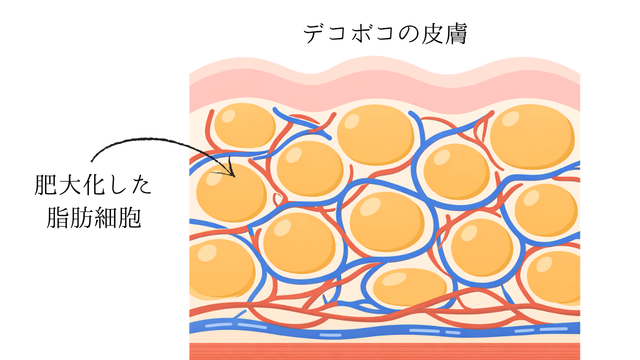 セルライトとは？