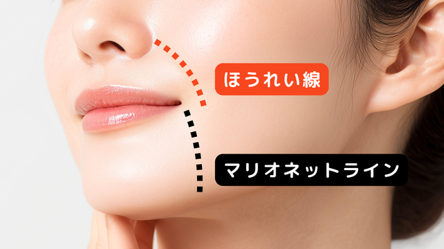 ほうれい線との違い