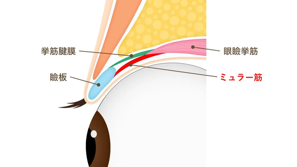 ミュラー筋を位置を紹介した図