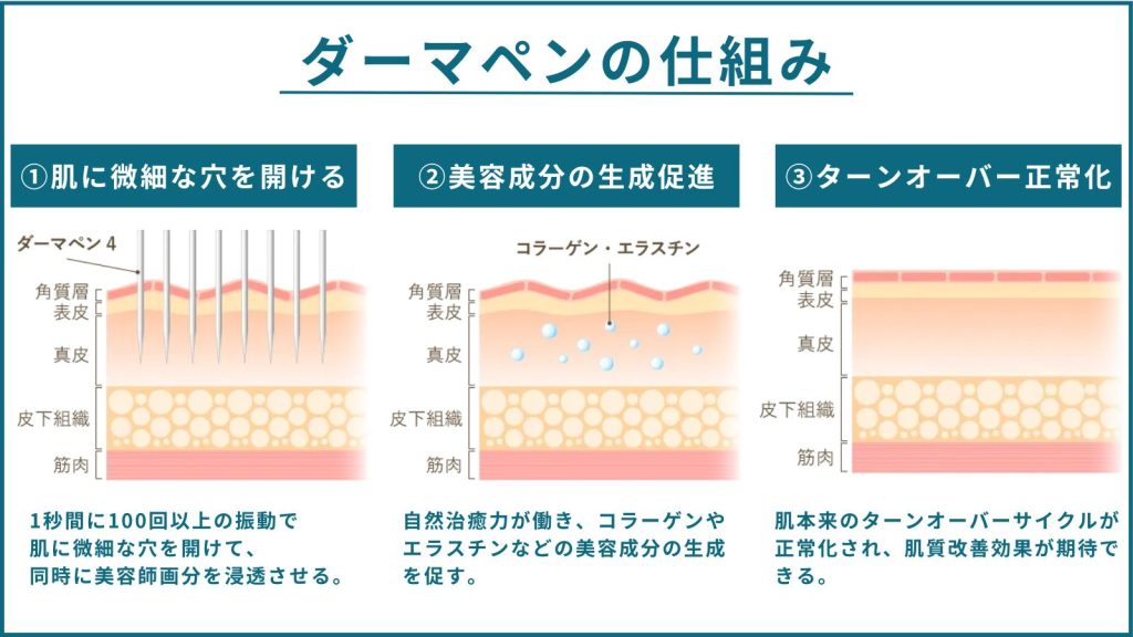 ダーマペンの仕組みの図