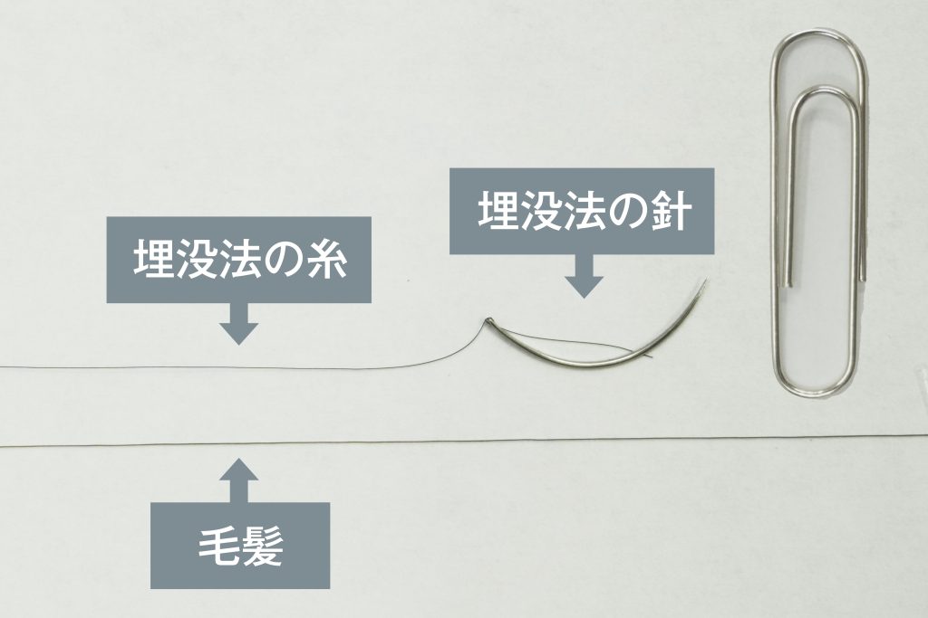 二重埋没法で使用する針と糸の画像