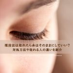 埋没法は取れたら糸はそのままにしていい？対処方法や取れる人の違いを紹介