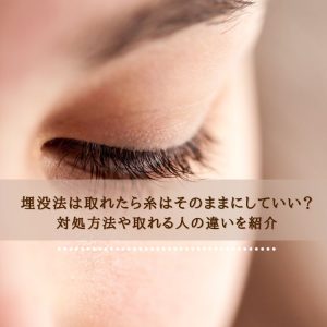 埋没法は取れたら糸はそのままにしていい？対処方法や取れる人の違いを紹介
