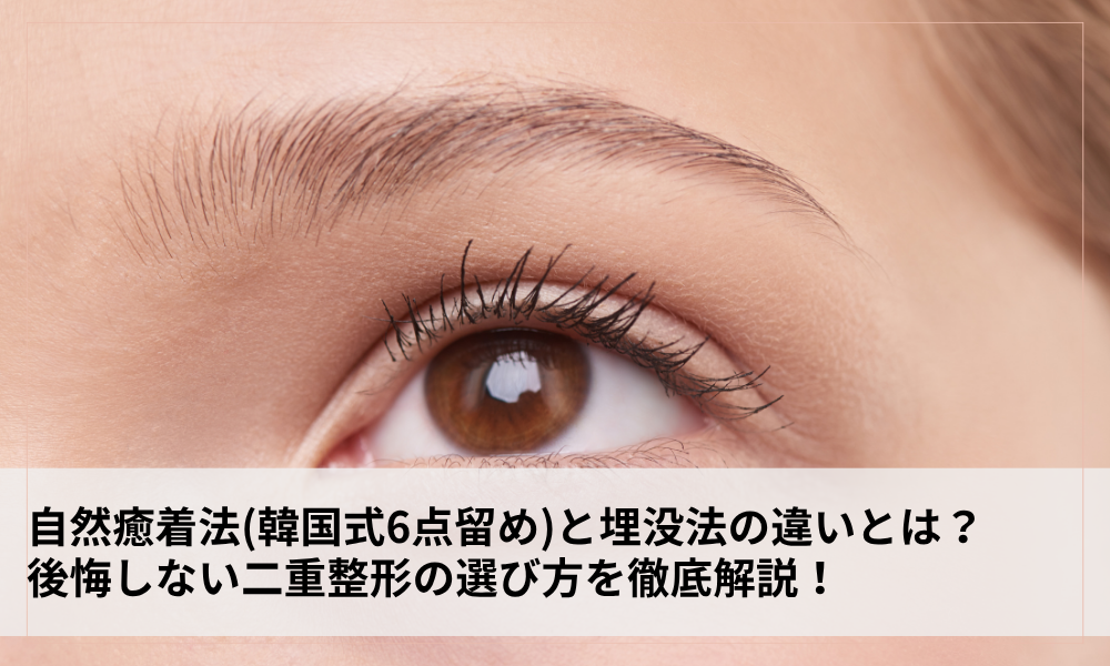 タイトル画像