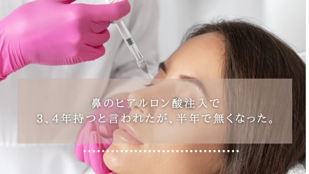 鼻のヒアルロン酸注入で3、4年持つと言われたが、半年で無くなった。