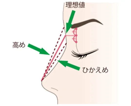 無理に高くしすぎない自然な仕上がり