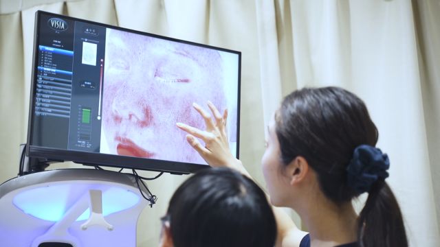 ニキビ跡の赤みの肌診断