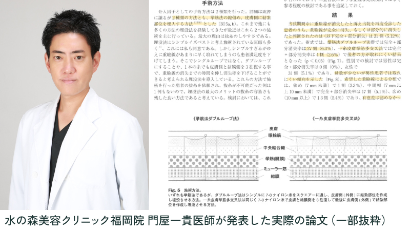 門屋医師の論文より一部抜粋