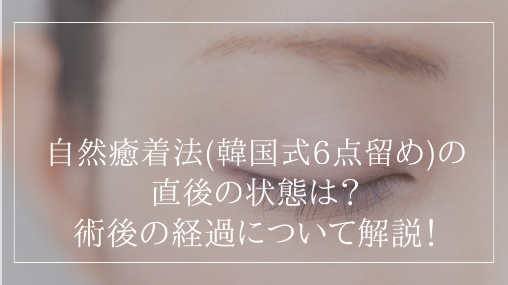自然癒着法(韓国式6点留め)の
直後の状態は？
術後の経過について解説！