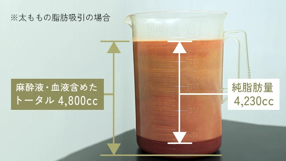 純脂肪量とは？