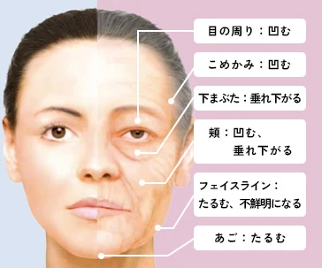 加齢が進んだお顔
