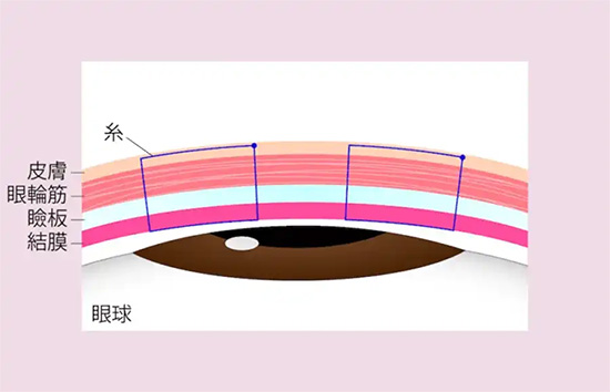 解剖学に基づいた糸の留め方