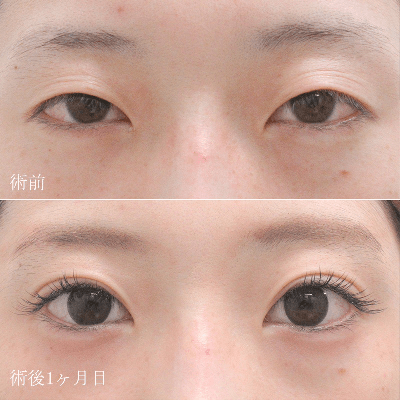症例写真1