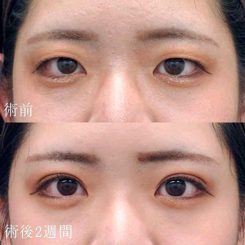 症例写真3