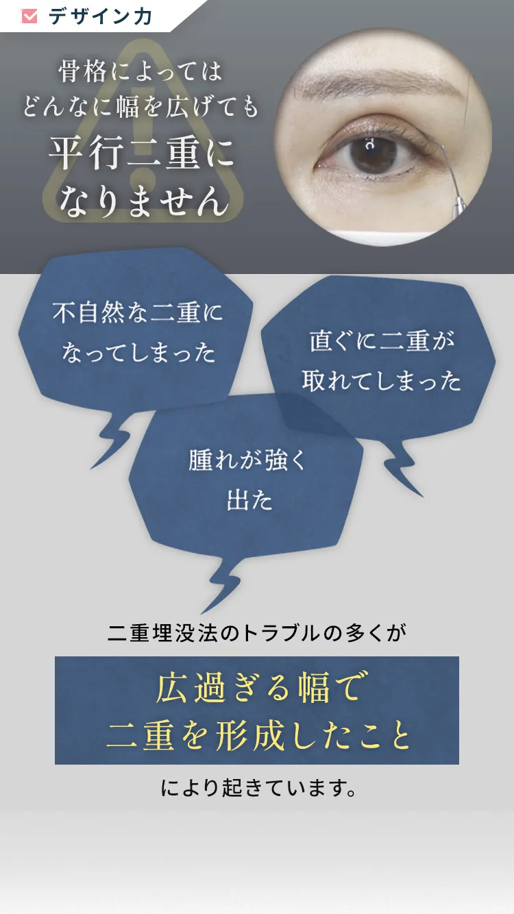 骨格によってはどんなに幅を広げても平行二重になりません「不自然な二重になってしまった」「直ぐに二重が取れてしまった」「腫れが強く出た」二重埋没法のトラブルの多くが広過ぎる幅で二重を形成したことにより起きています。