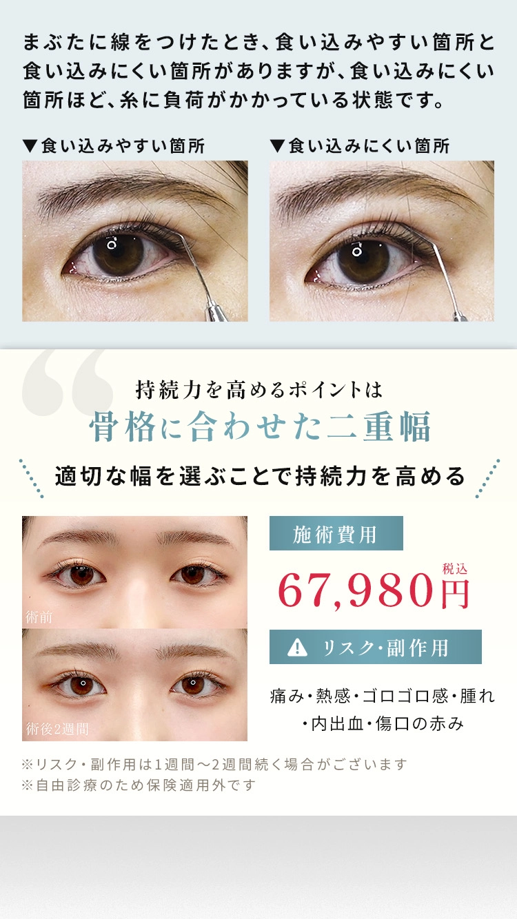 持続力を高めるポイントは骨格に合わせた二重幅