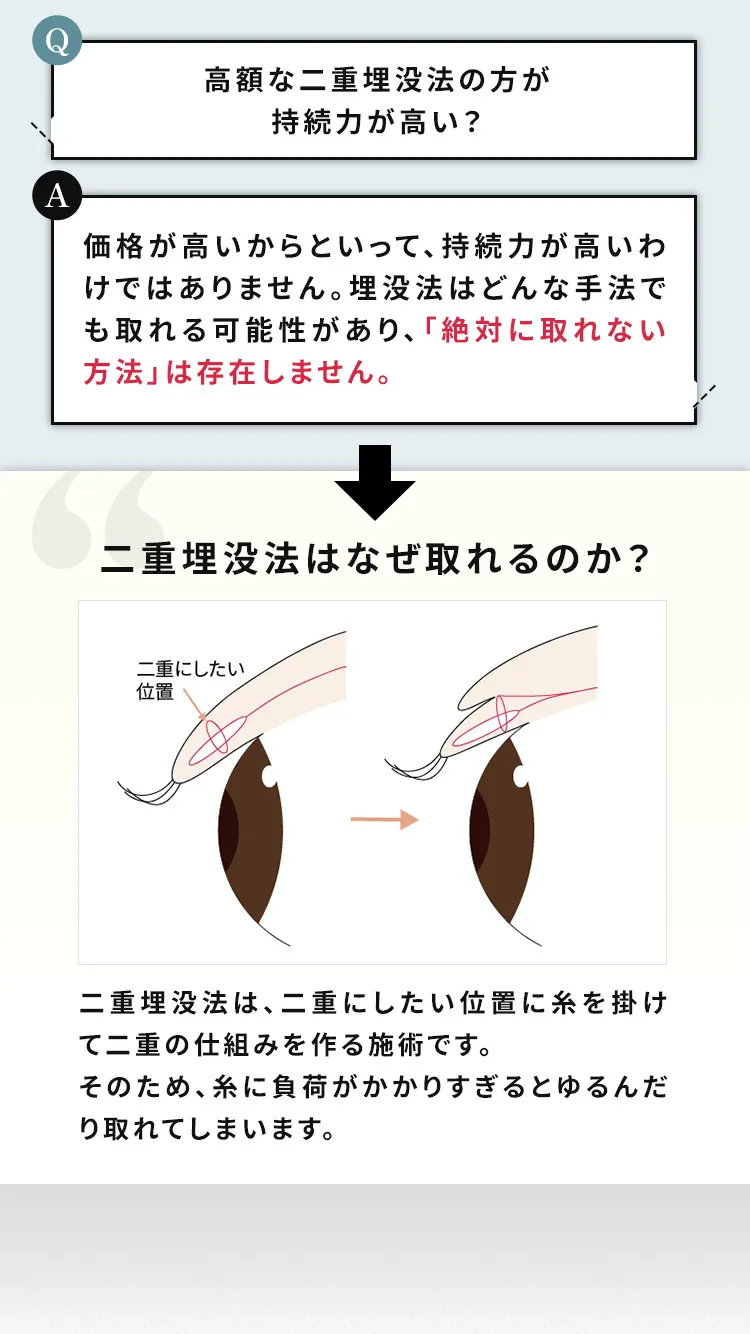 持続力を高めるポイントは骨格に合わせた二重幅