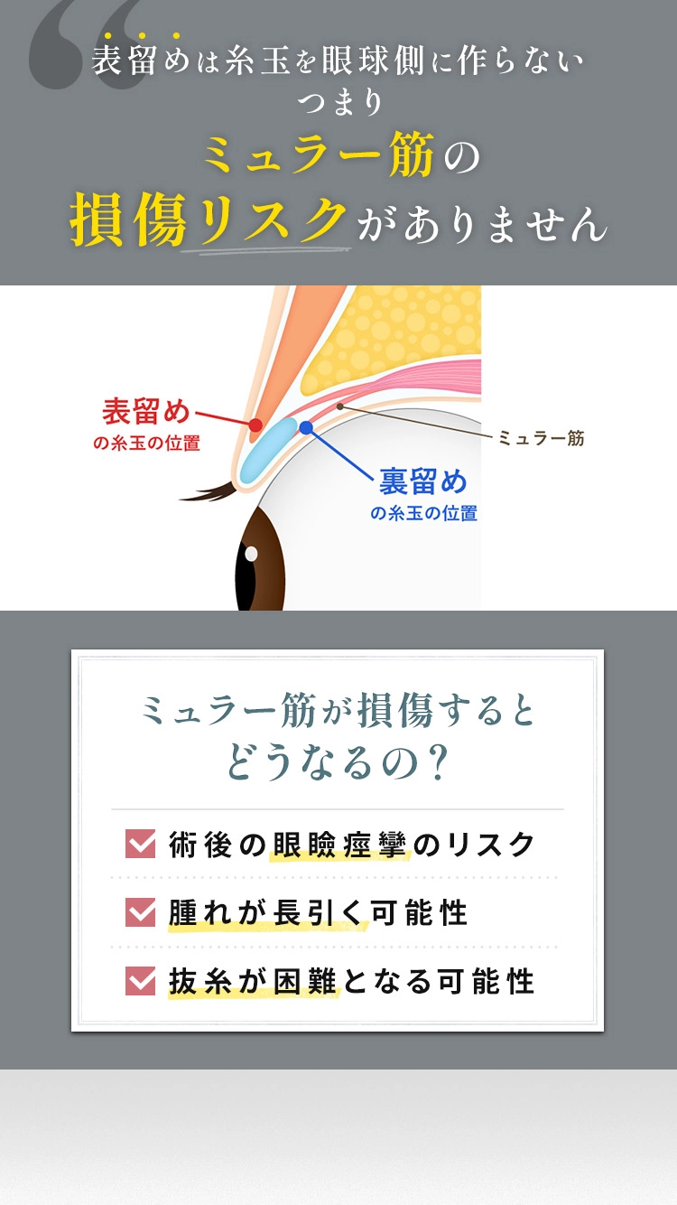 表留めは糸玉を眼球側に作らないつまりミュラー筋の損傷リスクがありません