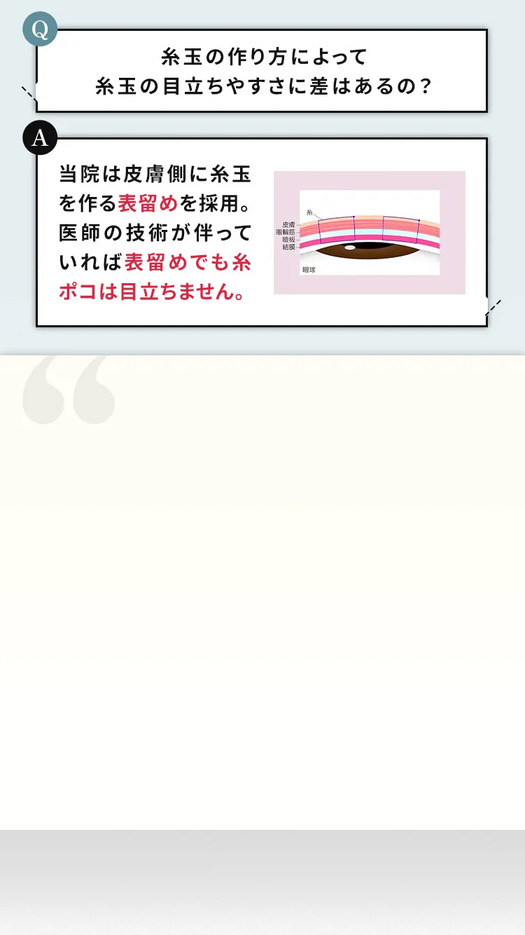 表留めは糸玉を眼球側に作らないつまりミュラー筋の損傷リスクがありません