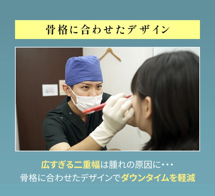 【広過ぎる二重幅は晴れの原因に】解剖を熟知した医師が骨格に合わせたデザインを行うことで、ダウンタイムの軽減が期待できます。