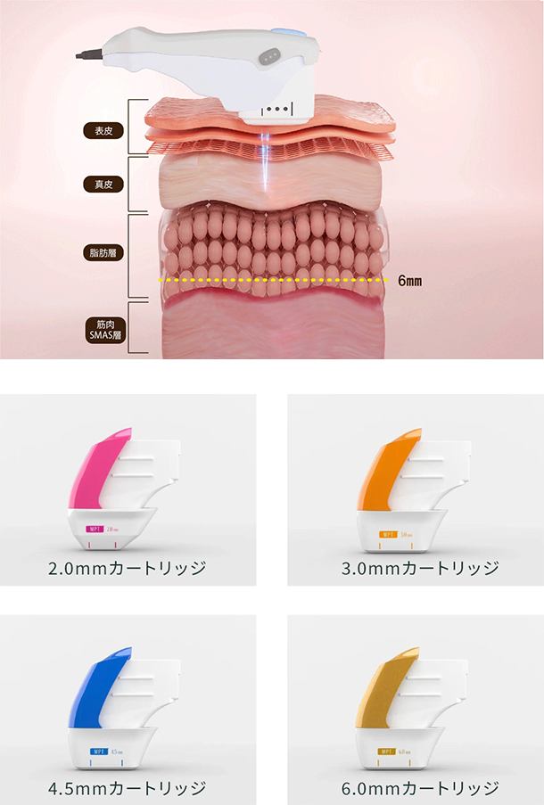 HIFU顎下ハイフ比較