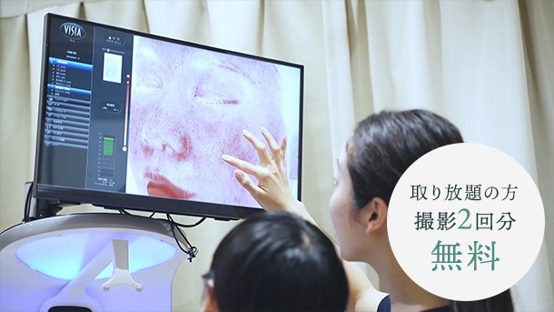 取り放題の方 撮影2回分無料