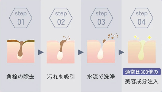 角質除去 ⇀ 吸引毛穴洗浄 ⇀ 汚れを剥がした皮膚 ⇀ 毛穴から美容成分導入