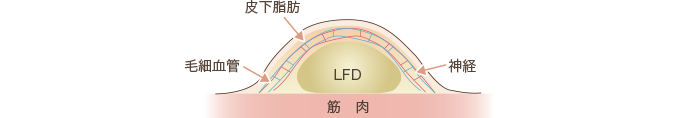 水抜き2