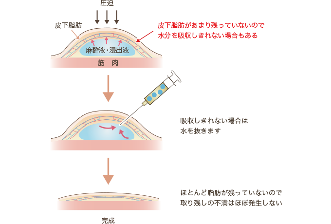 水抜き7