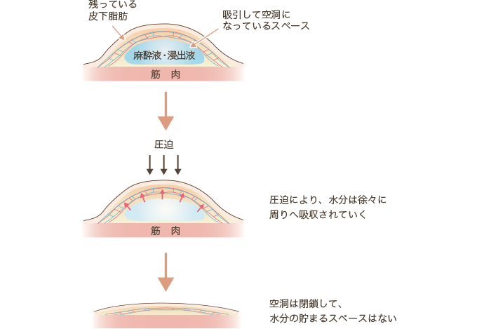 水抜き9