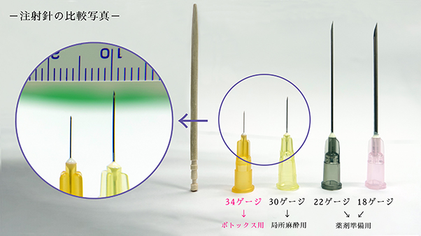 ボトックス注射針の詳細比較