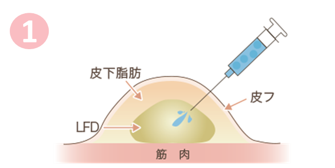 脂肪層説明図