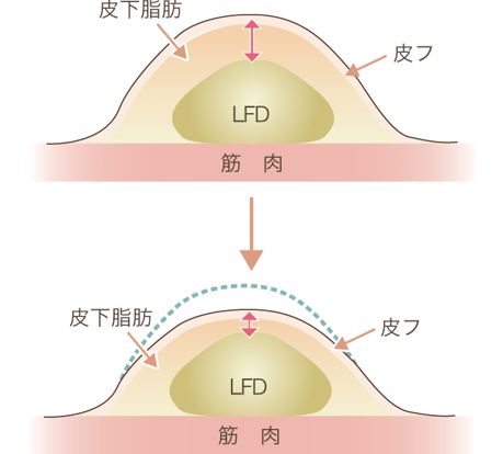 ダイエットの場合説明図
