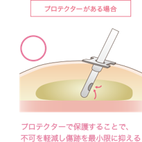 脂肪吸引 痩身の整形 美容整形なら水の森美容外科 公式 総合サイト 脂肪吸引 痩身の整形 美容整形なら水の森美容外科 公式 総合サイト