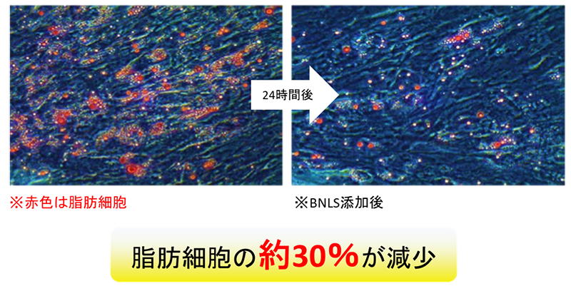 脂肪細胞の約30%が減少