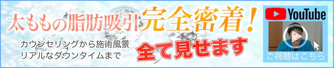 太ももの脂肪吸引完全密着！カウンセリングから施術風景　リアルなダウンタウンまで全て見せます