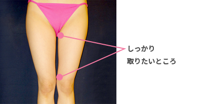 まっすぐなラインの脚に仕上げるためしっかり取りたいところの図