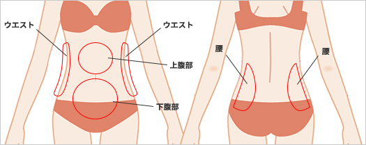 診療項目脂肪吸引 痩身 腹部 ウエスト 腰 美容整形 美容外科なら水の森美容外科 公式 総合サイト 診療項目脂肪吸引 痩身 腹部 ウエスト 腰 美容整形 美容外科なら水の森美容外科 公式 総合サイト
