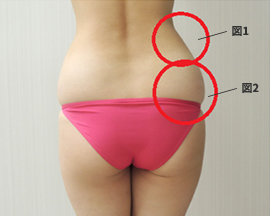 腰の部位別　脂肪の質の違い説明画像1