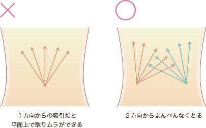 クリスクロス法の説明画像