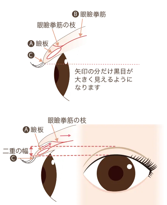 二重の仕組み図