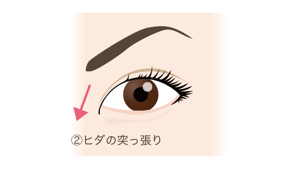 二重まぶた 目もとの整形施術一覧 美容整形なら水の森美容外科 公式 総合サイト 二重まぶた 目もとの整形施術一覧 美容整形なら水の森美容外科 公式 総合サイト